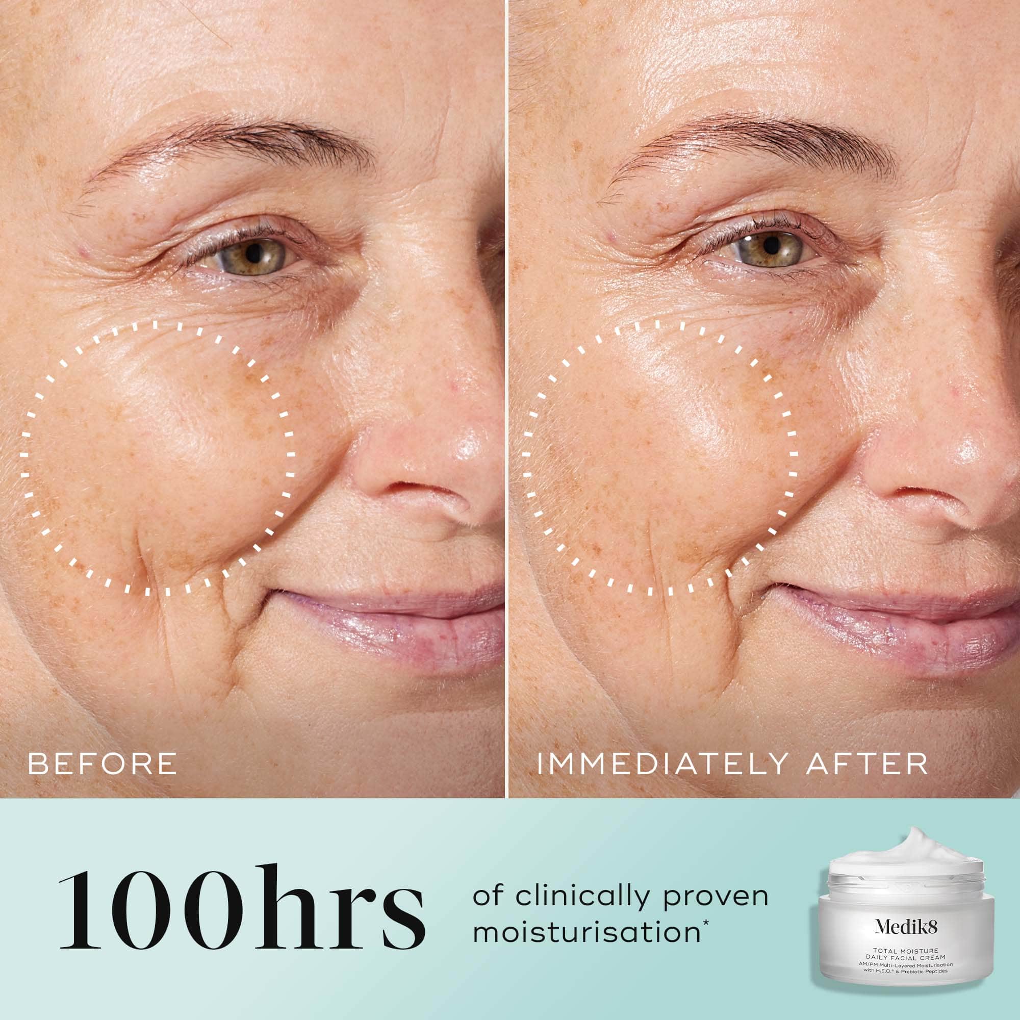 Medik8 Total Moisture Daily Facial Cream Refill™