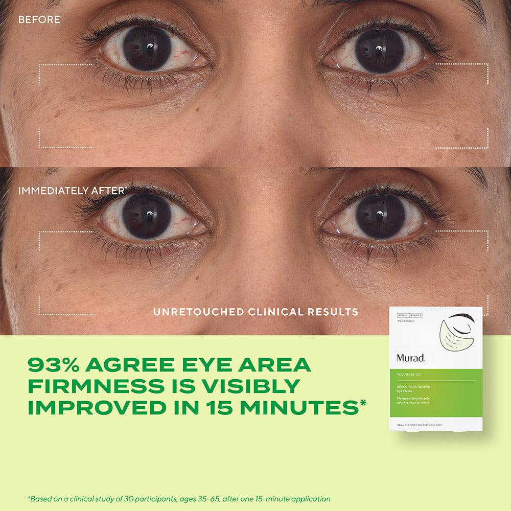 Murad Retinol Youth Renewal Eye Masks - 5 Pairs