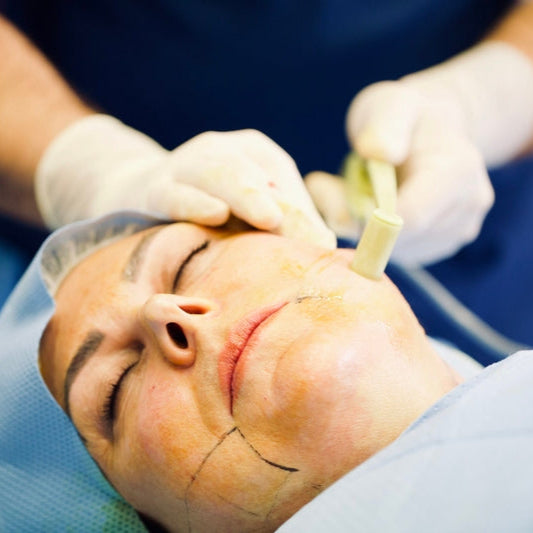 A person receiving a skin tightening treatment on their face using a device.