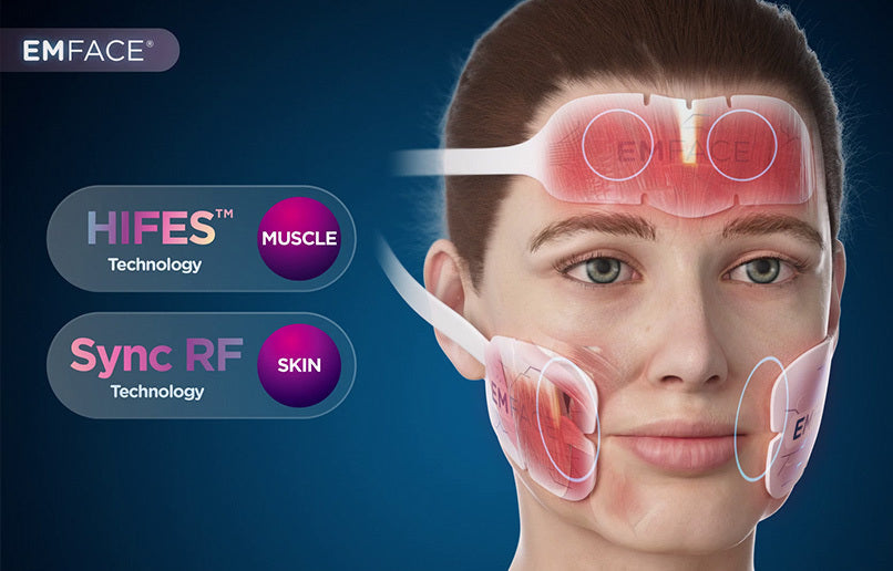 EMFACE anti-wrinkle lifting treatment Course of 3 +Anti-Wrinkle Injections 2/3 Areas (save €201)