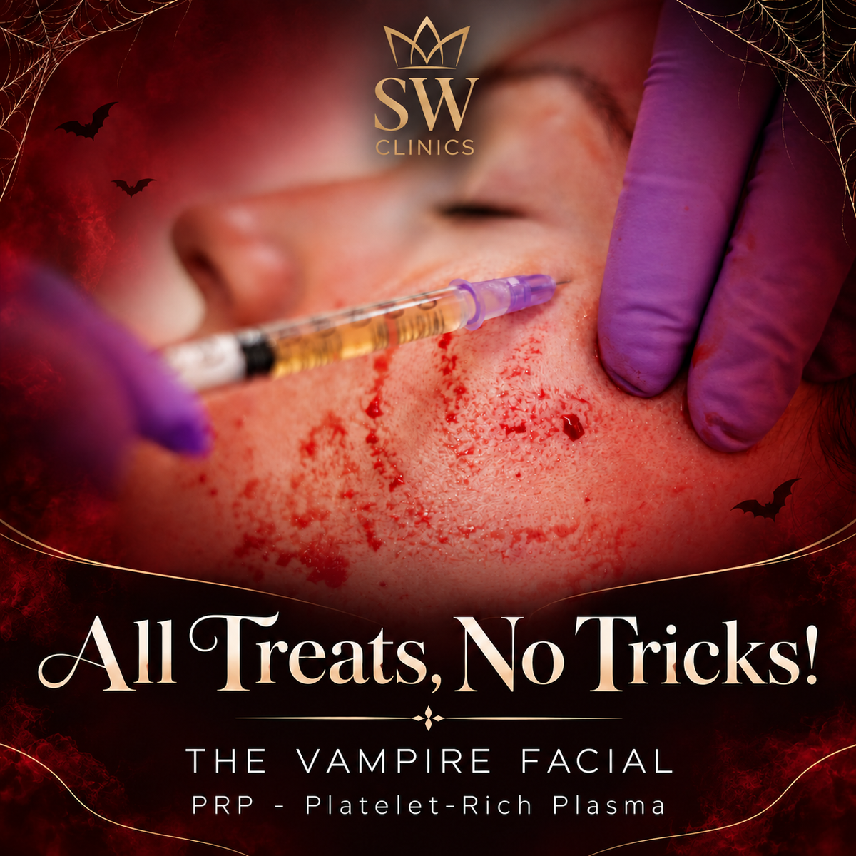 Halloween Exclusive: The Vampire Facial (PRP) from only €299!