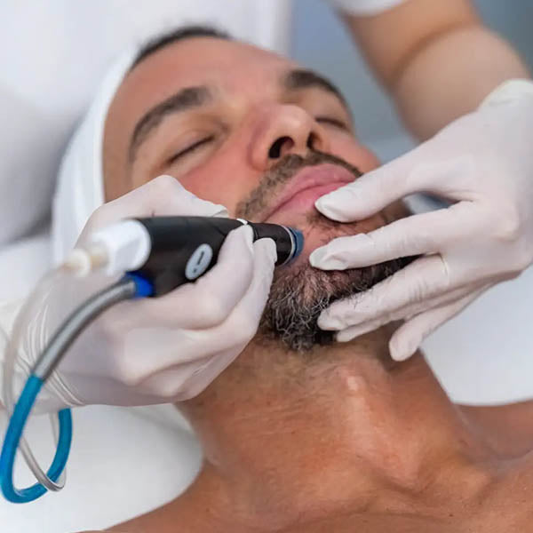 Summer Six City Radiance: Choice of Facial or Peel with LED (save up to €201)
