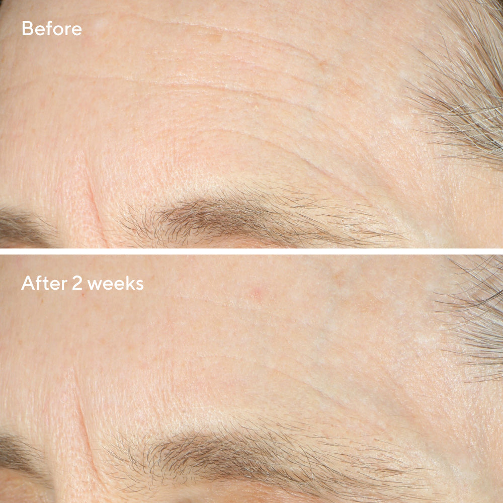 Murad Intense Recovery Cream 50ml