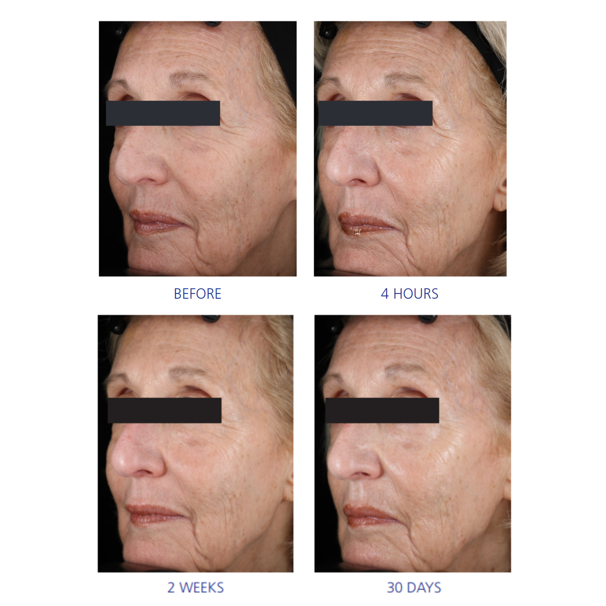 iS Clinical Youth Eye Complex 15g