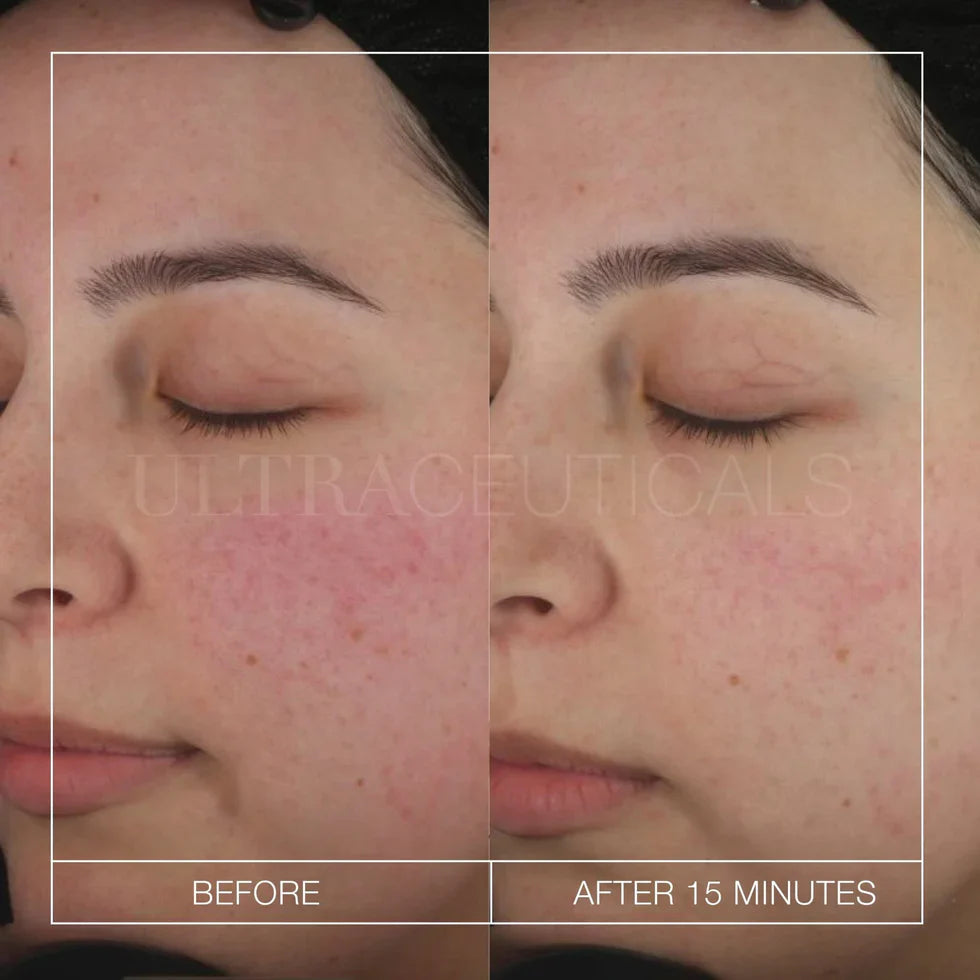 Ultra B² Recovery Cream 50ml