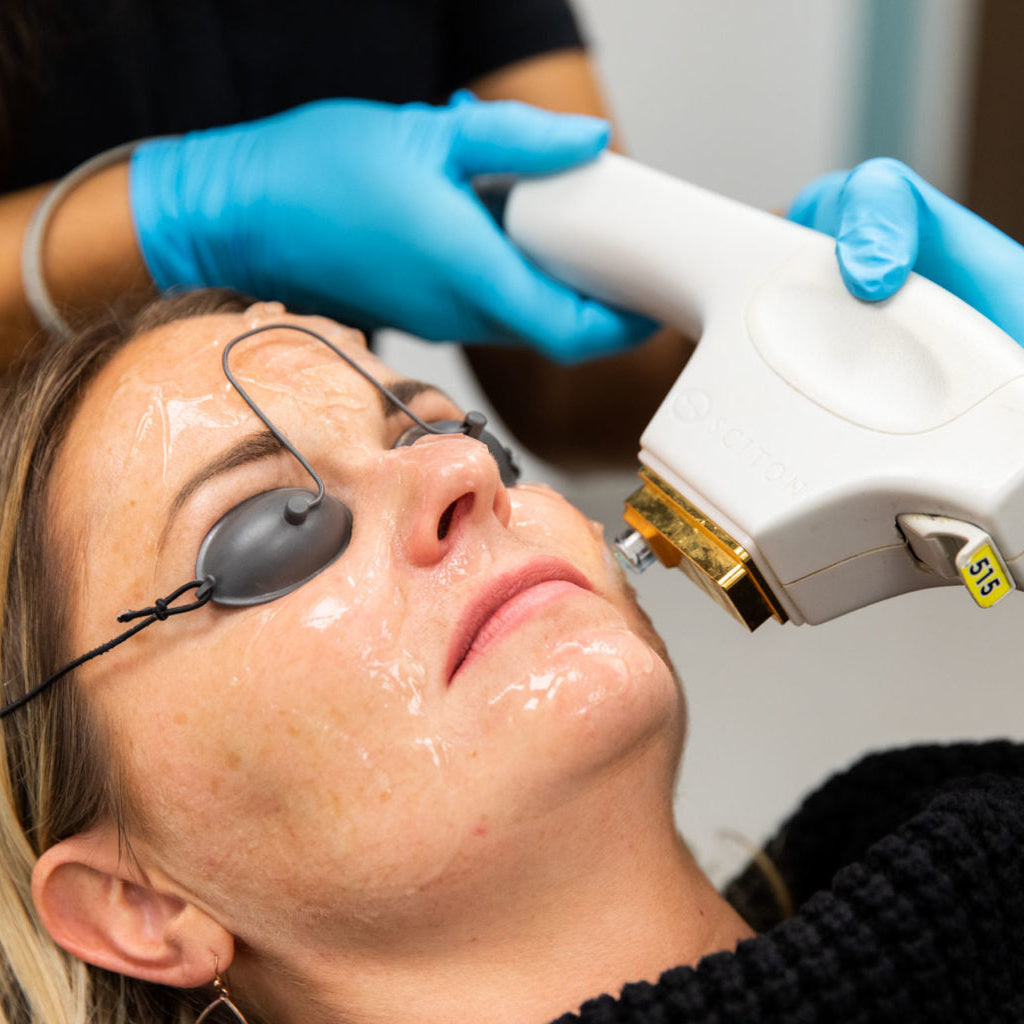 BBL Skin Rejuvenation Course of 2 (save up to €401)