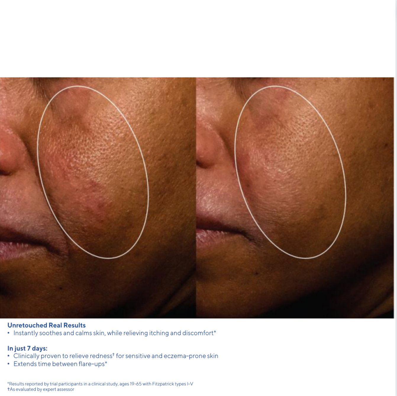 Murad Quick Relief Moisture Treatment