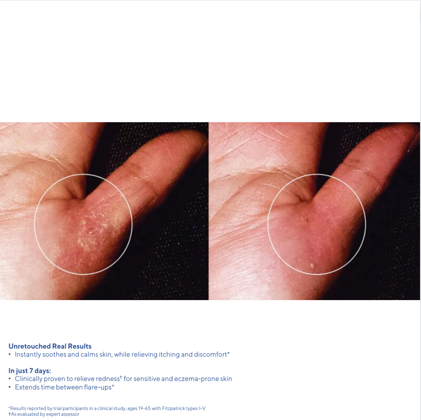 Murad Quick Relief Moisture Treatment