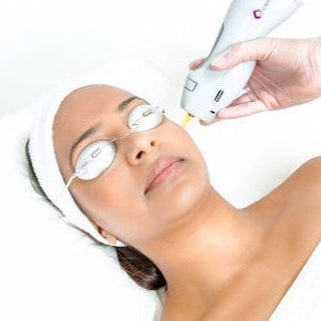 Laser Hair Removal for any small area (as low as €35 per session)