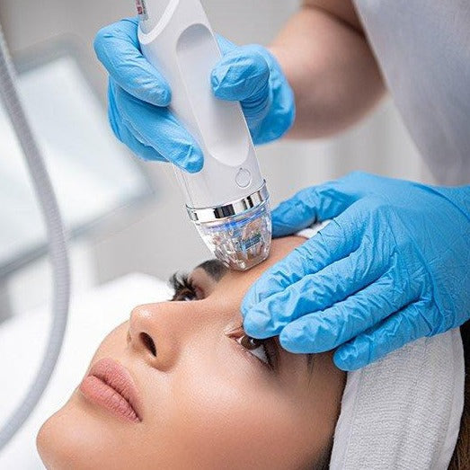 Secret RF +Microneedling & CO2 Laser Duo with Exosomes (save up to €701)