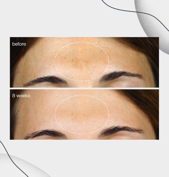 Dermalogica powerbright dark spot serum