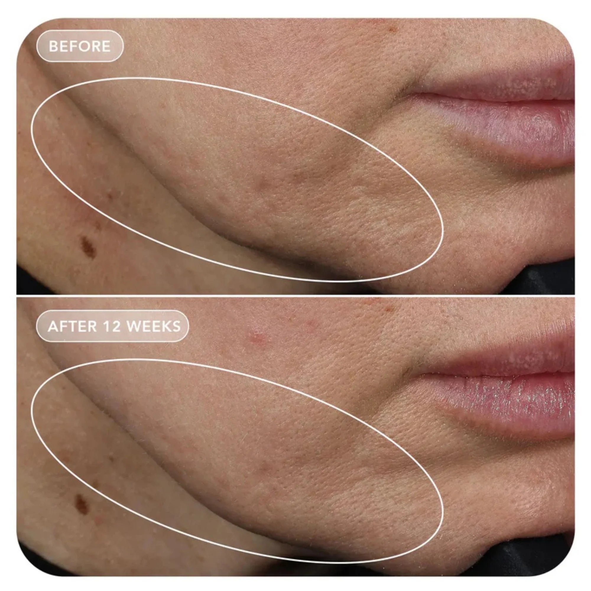 Image Skincare VOL.U.LIFT™ 4D Skin Rebound Complex