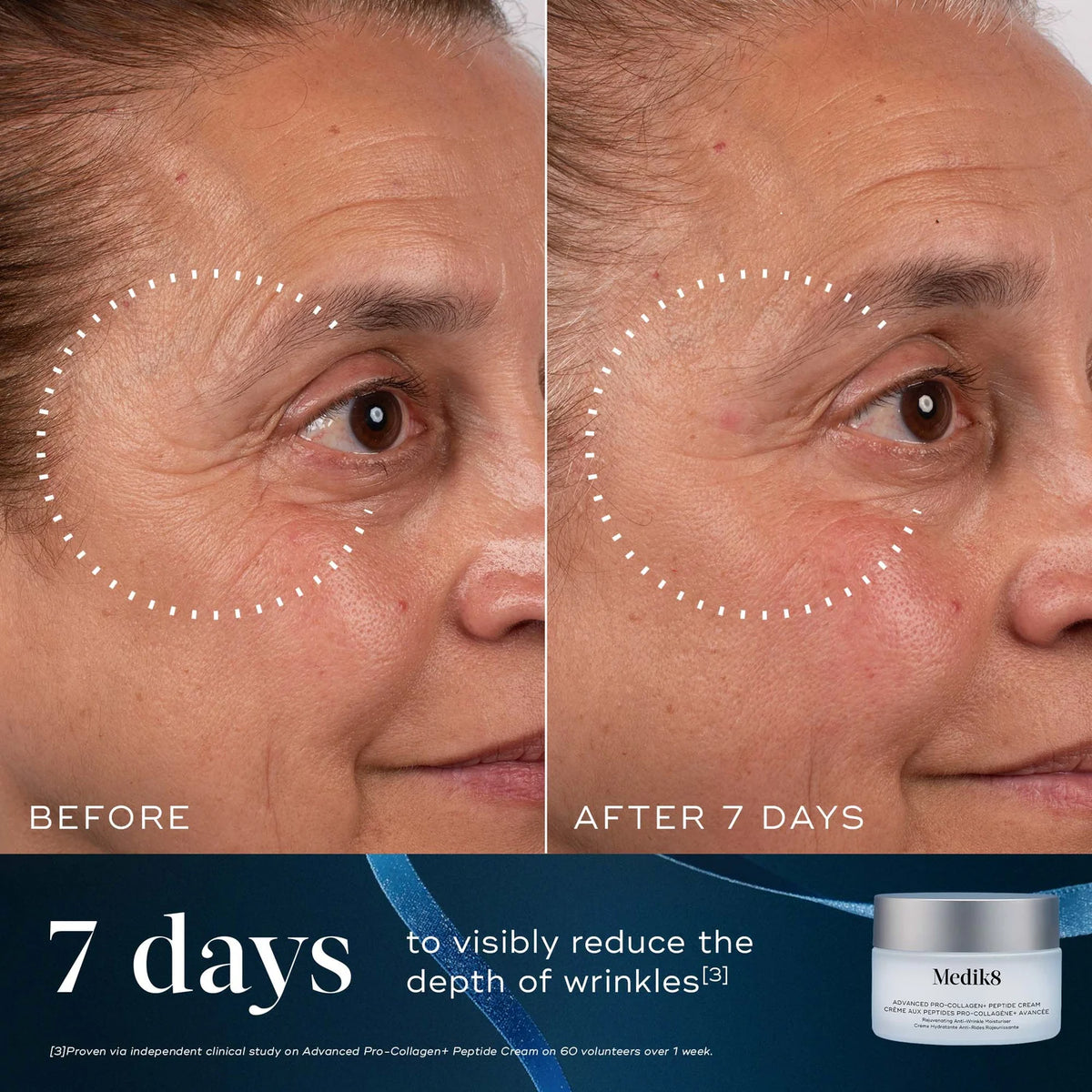 Medik8 Age-Defying Essentials Kit