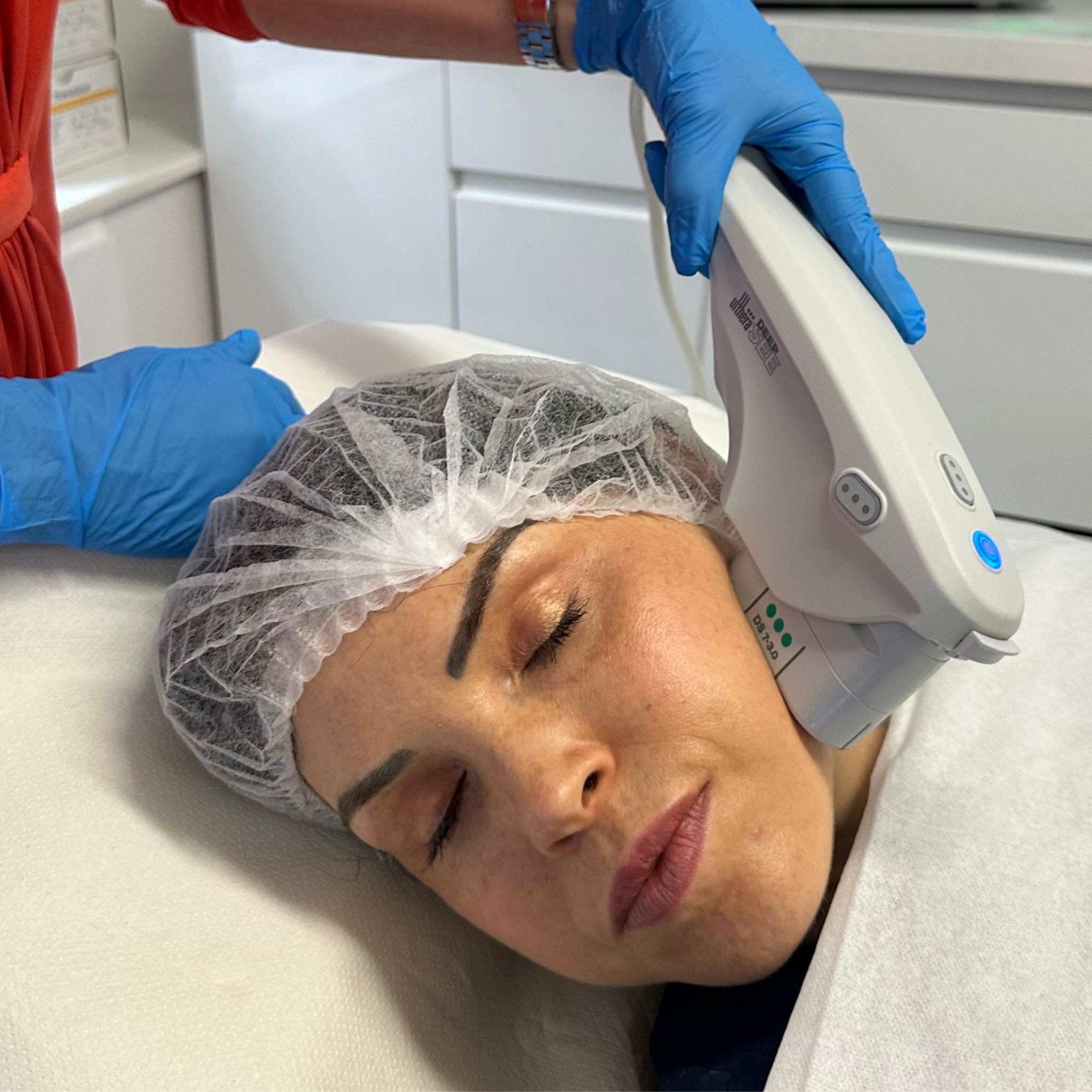 Ultherapy Non-Surgical Face Lift & Skin Tightening (save up to €801)