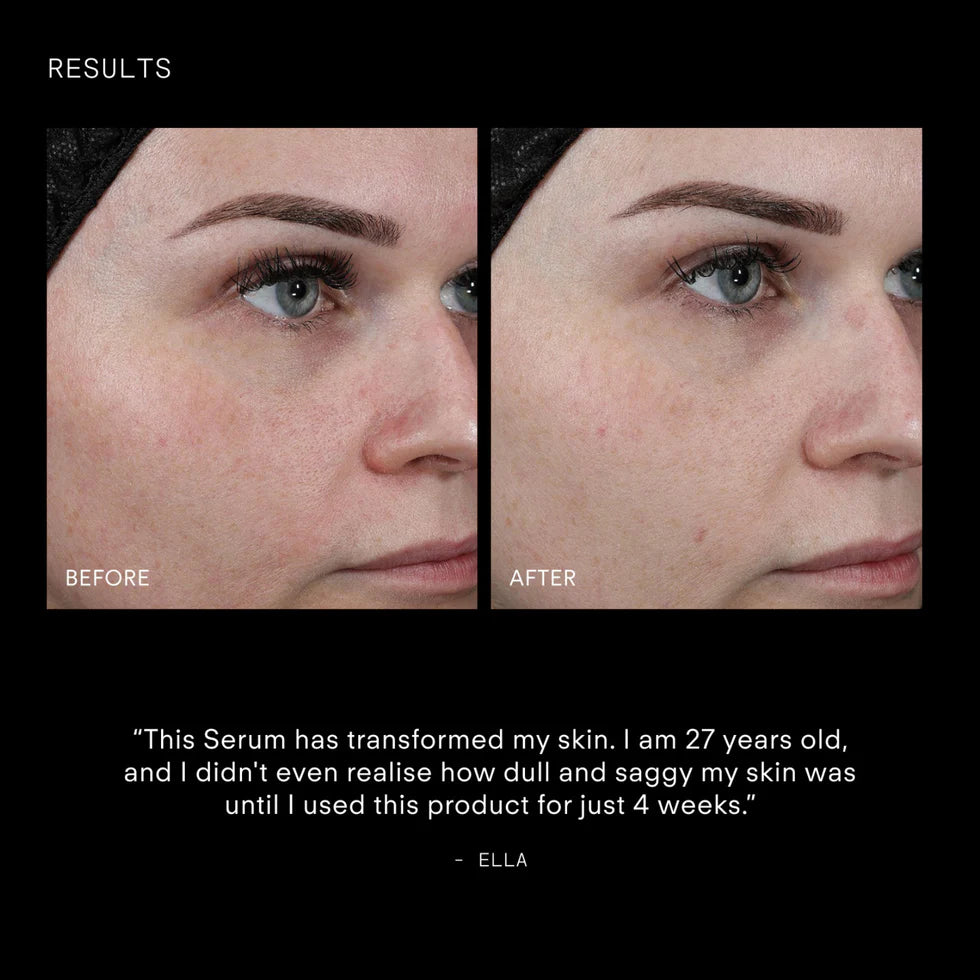 Ultraceuticals  Youth Boost ExoSignal GF² Facial Serum