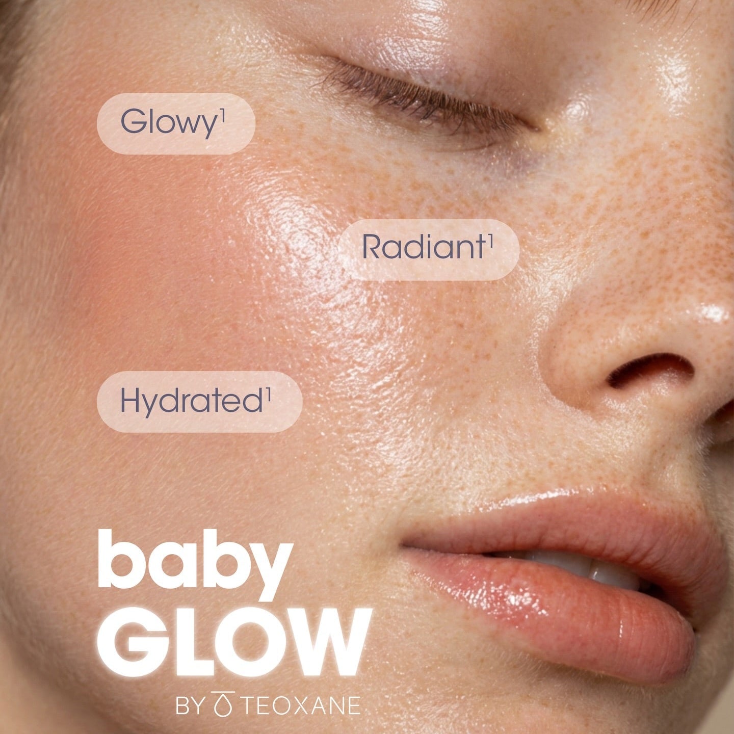 Teoxane Baby Glow Skin Booster Course of 3 (save up to €401)