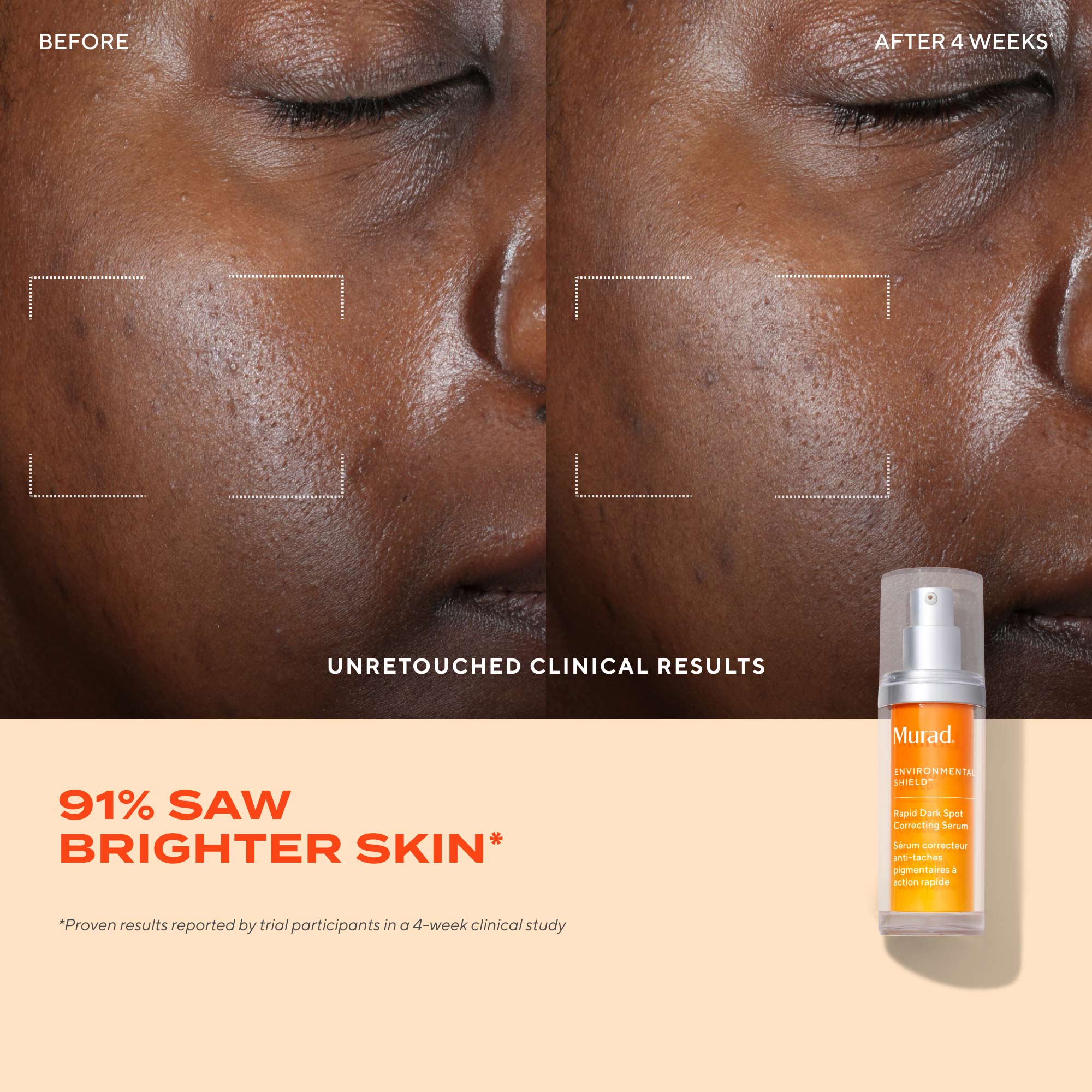 Murad Rapid Dark Spot Correcting Serum 30ml