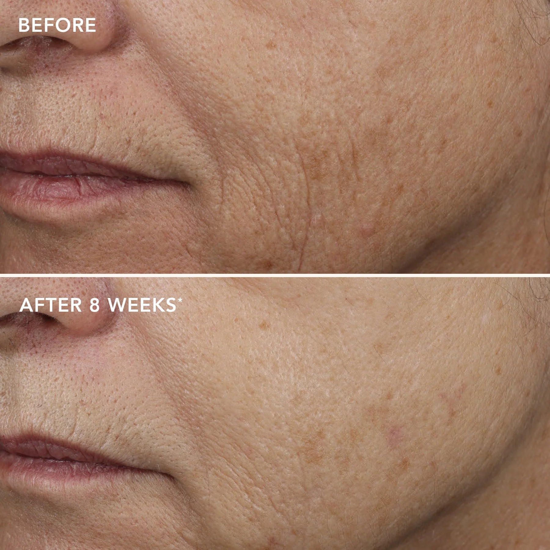 Image Skincare AGELESS+ Retinol Repair Crème 0.5% Retinol Complex