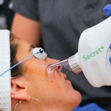 CO2 Laser Glow Facial (save €301)