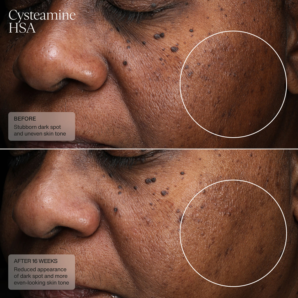 Sente Pigment & Tone Correcting Mask, Cysteamine + HSA