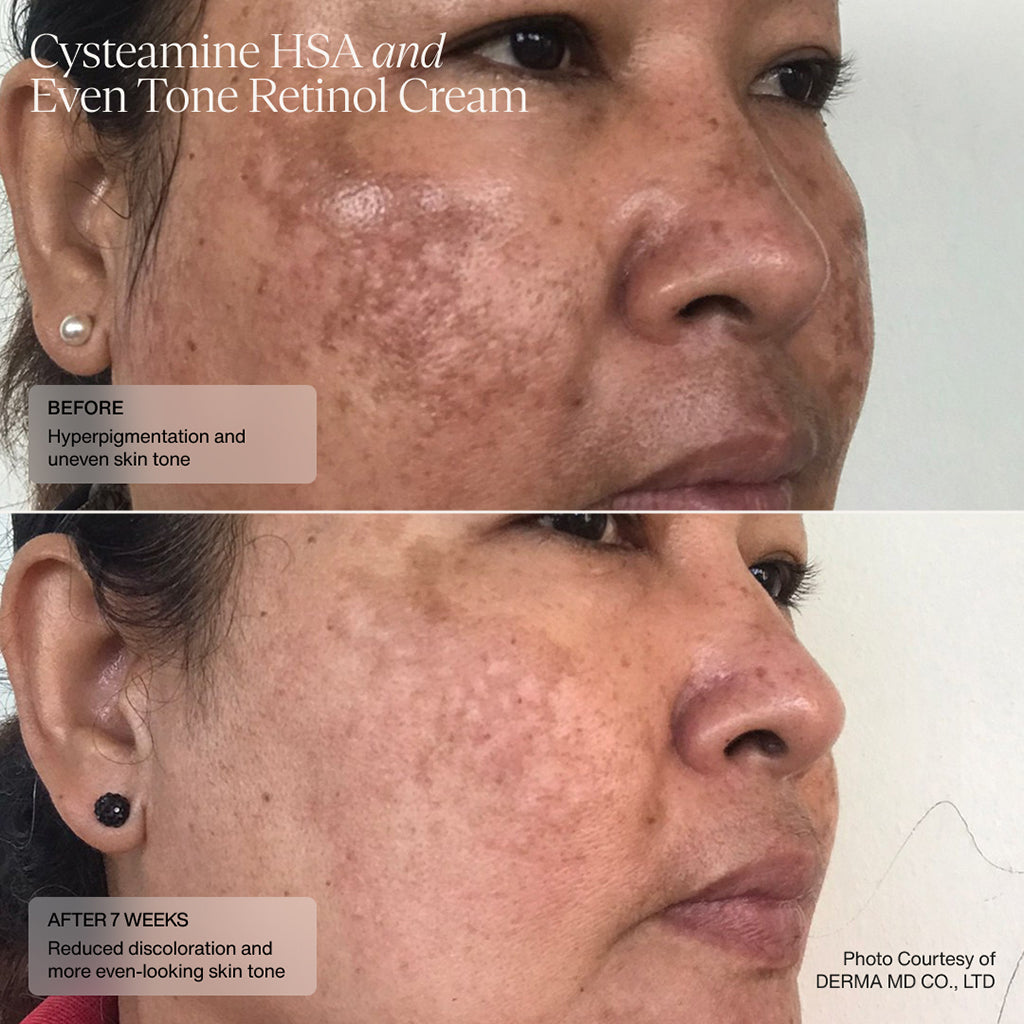 Sente Pigment & Tone Correcting Mask, Cysteamine + HSA