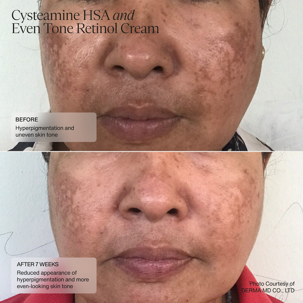 Sente Pigment & Tone Correcting Mask, Cysteamine + HSA