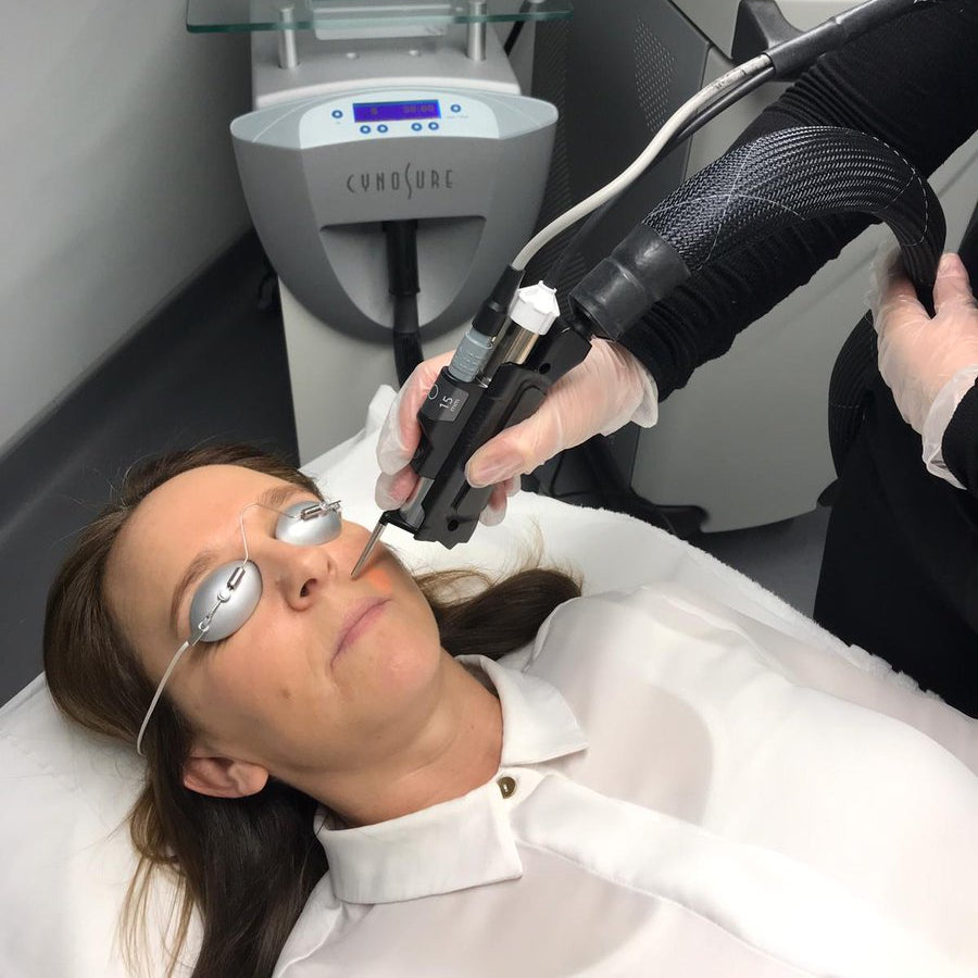 Laser thread vein reduction for small area course of 4 (save €301)