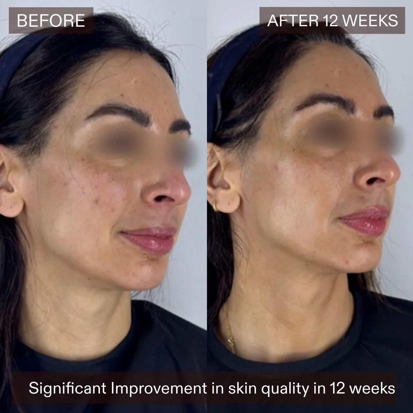 The Skin Diary The Ultimate Skin Ageing Duo