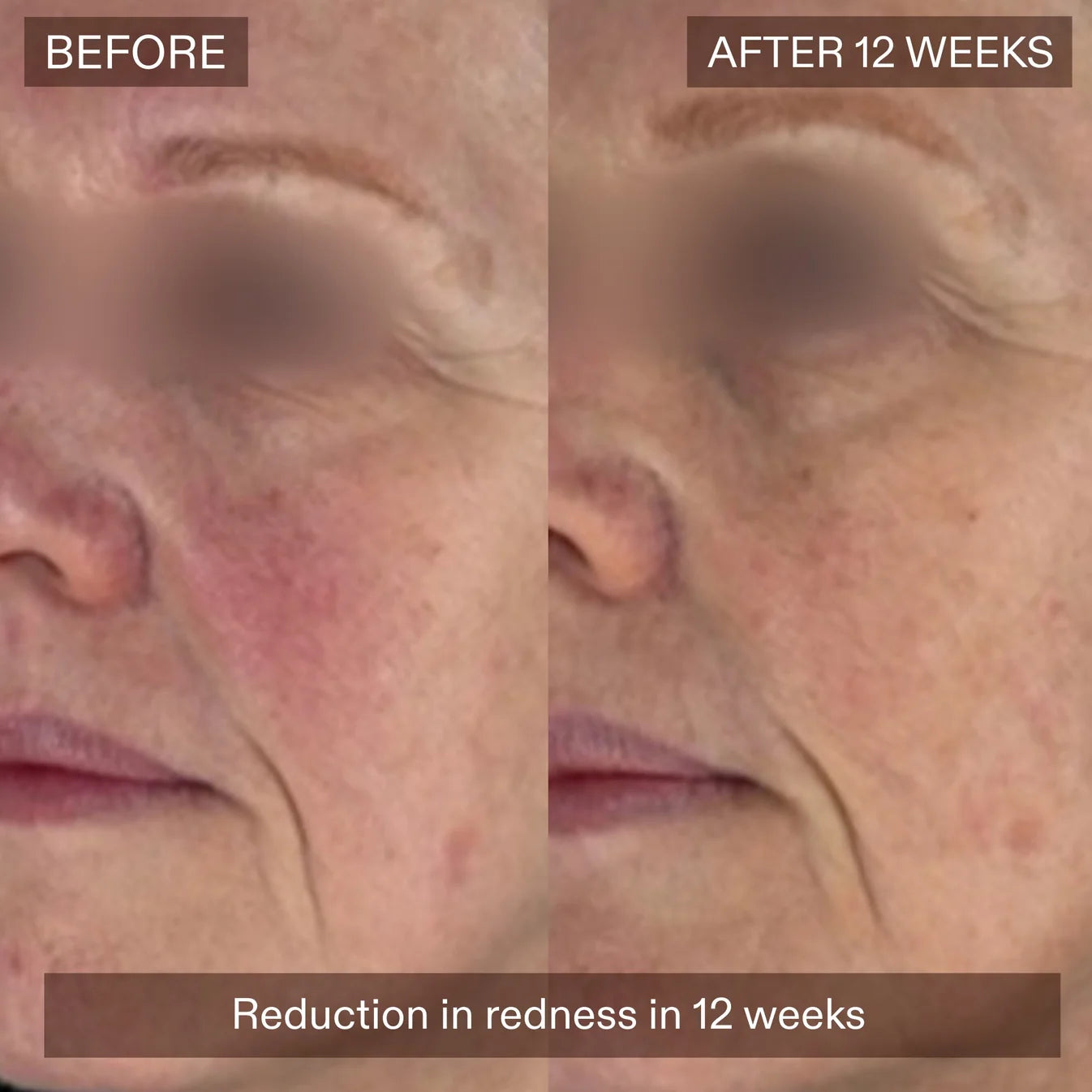 The Skin Diary The Ultimate Skin Ageing Duo