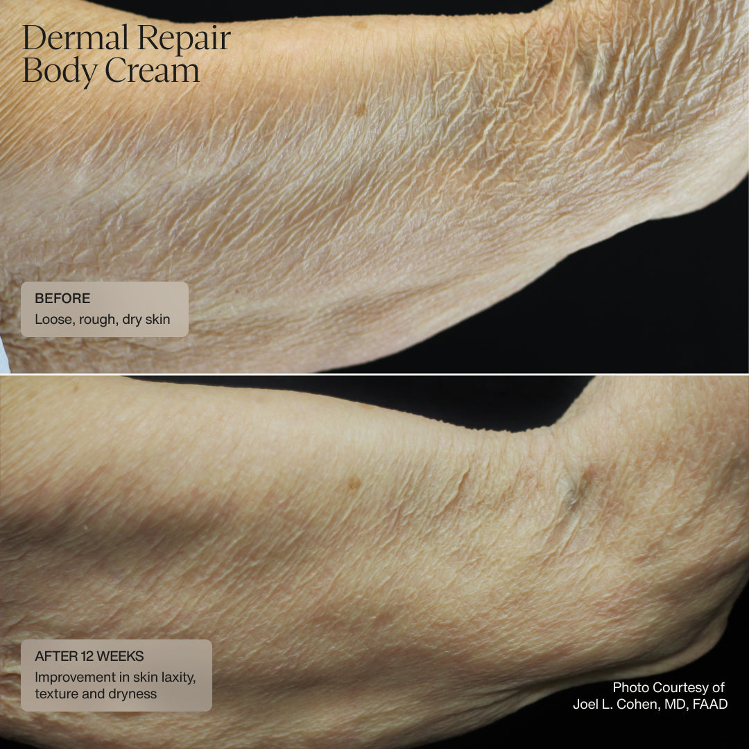 Sente Dermal Repair Body Cream