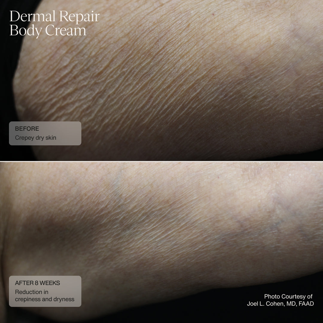 Sente Dermal Repair Body Cream