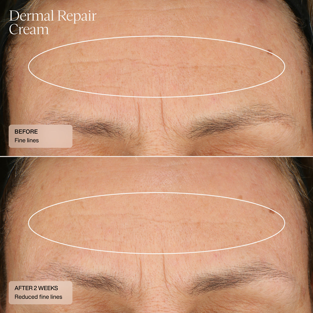 Sente Dermal Repair Cream 50 ml