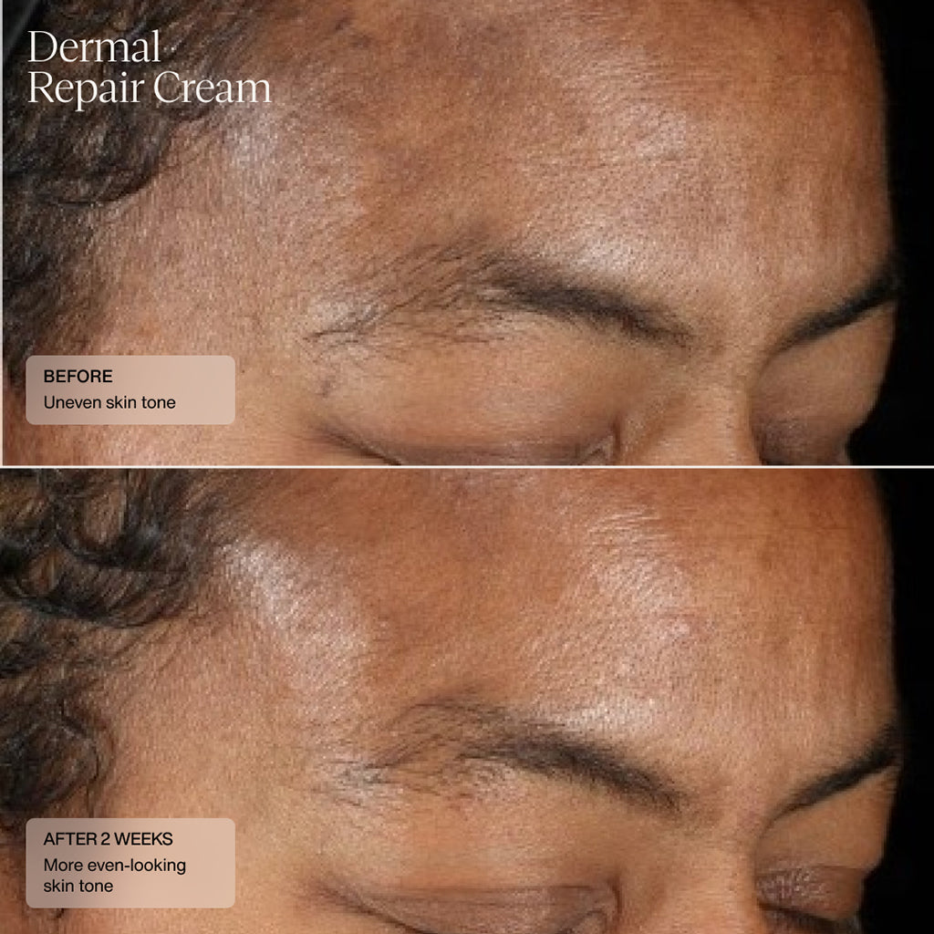 Sente Dermal Repair Cream 50 ml