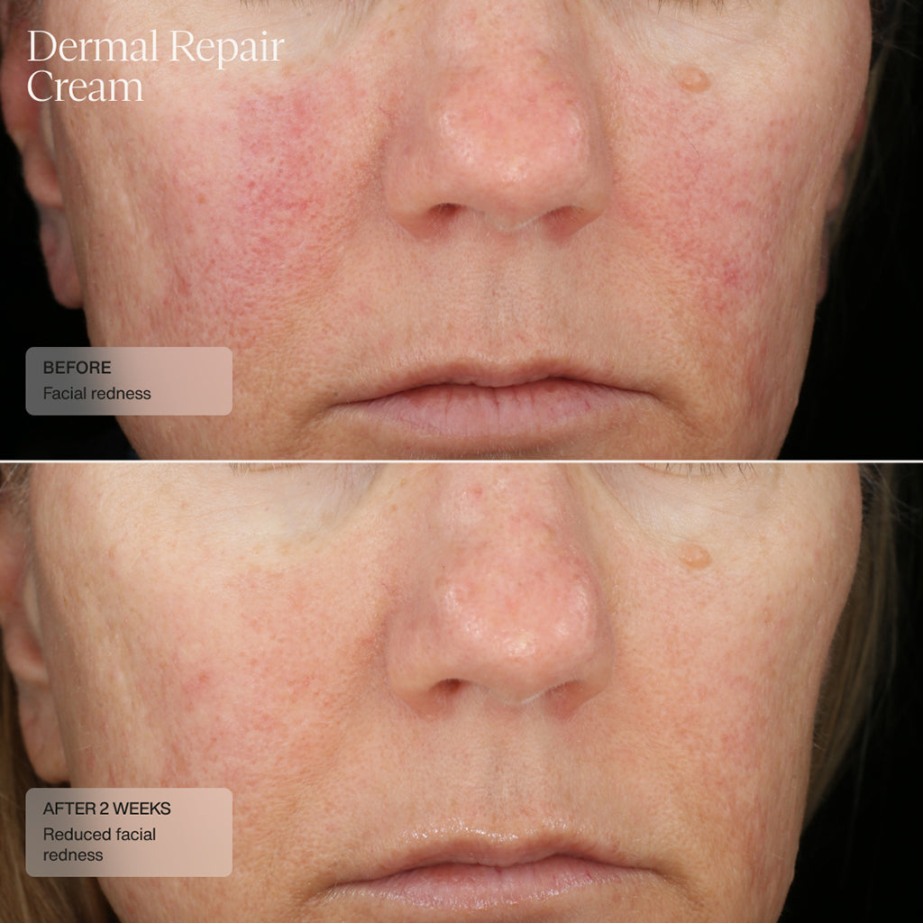 Sente Dermal Repair Cream 50 ml