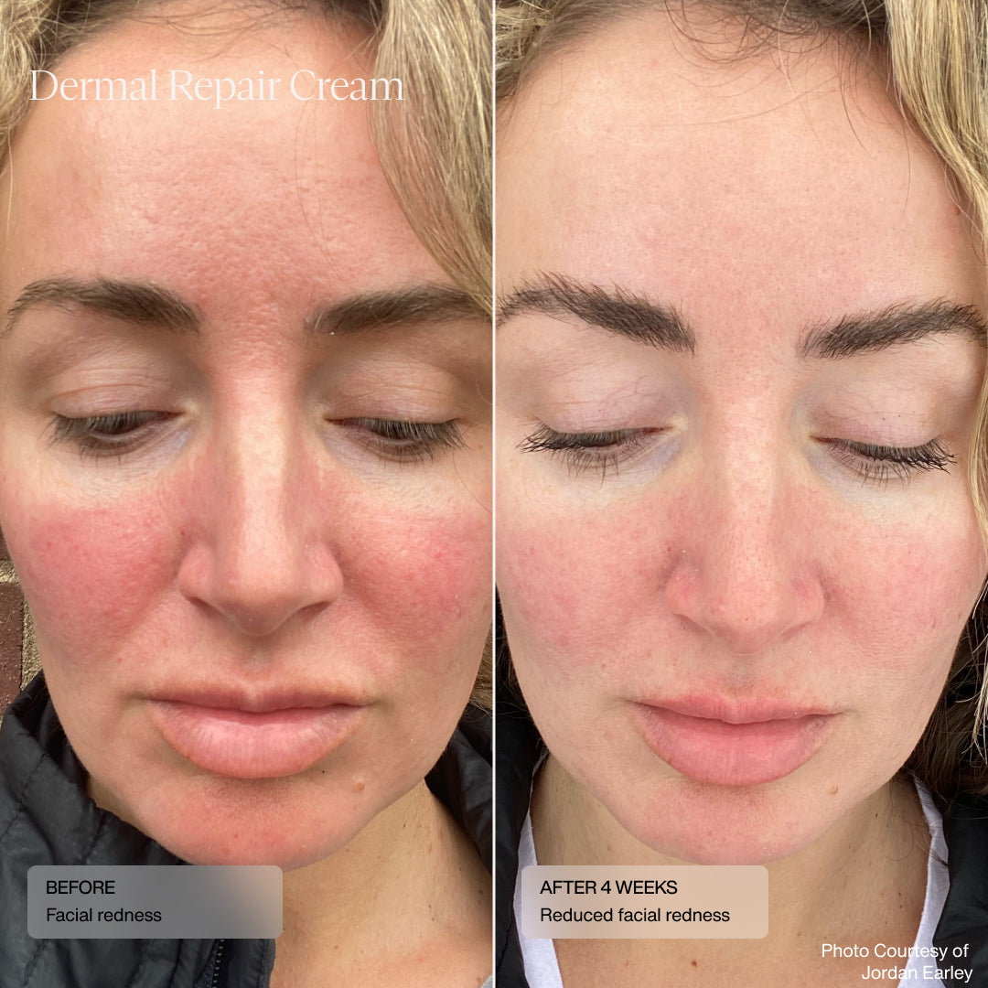 Sente Dermal Repair Cream 50 ml
