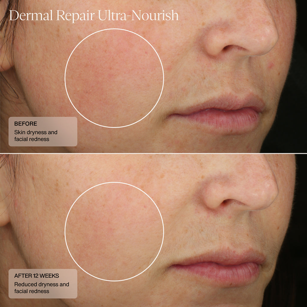 Sente Dermal Repair Ultra-Nourish