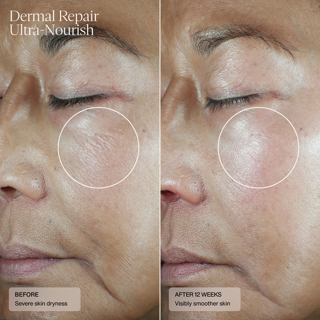 Sente Dermal Repair Ultra-Nourish