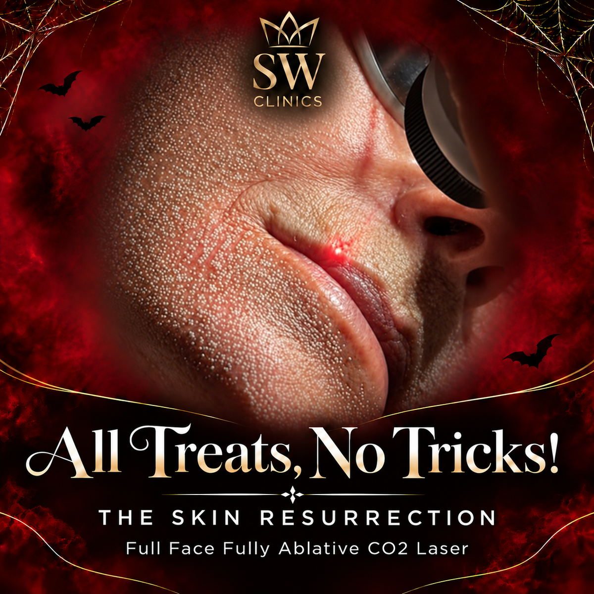Halloween Exclusive: The Skin Resurrection Full Face CO2 Laser (save up to €751)
