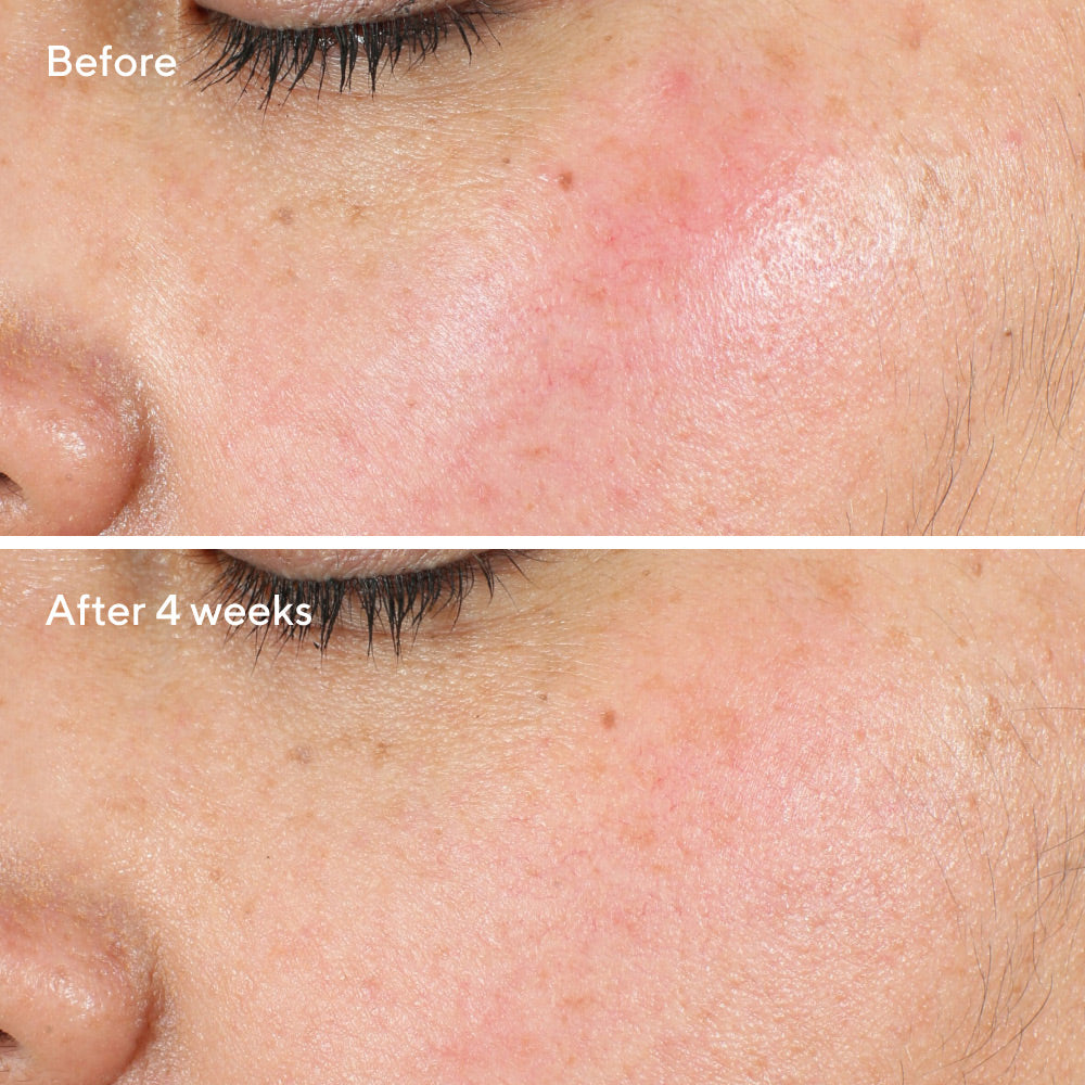 Murad Intense Recovery Cream 50ml