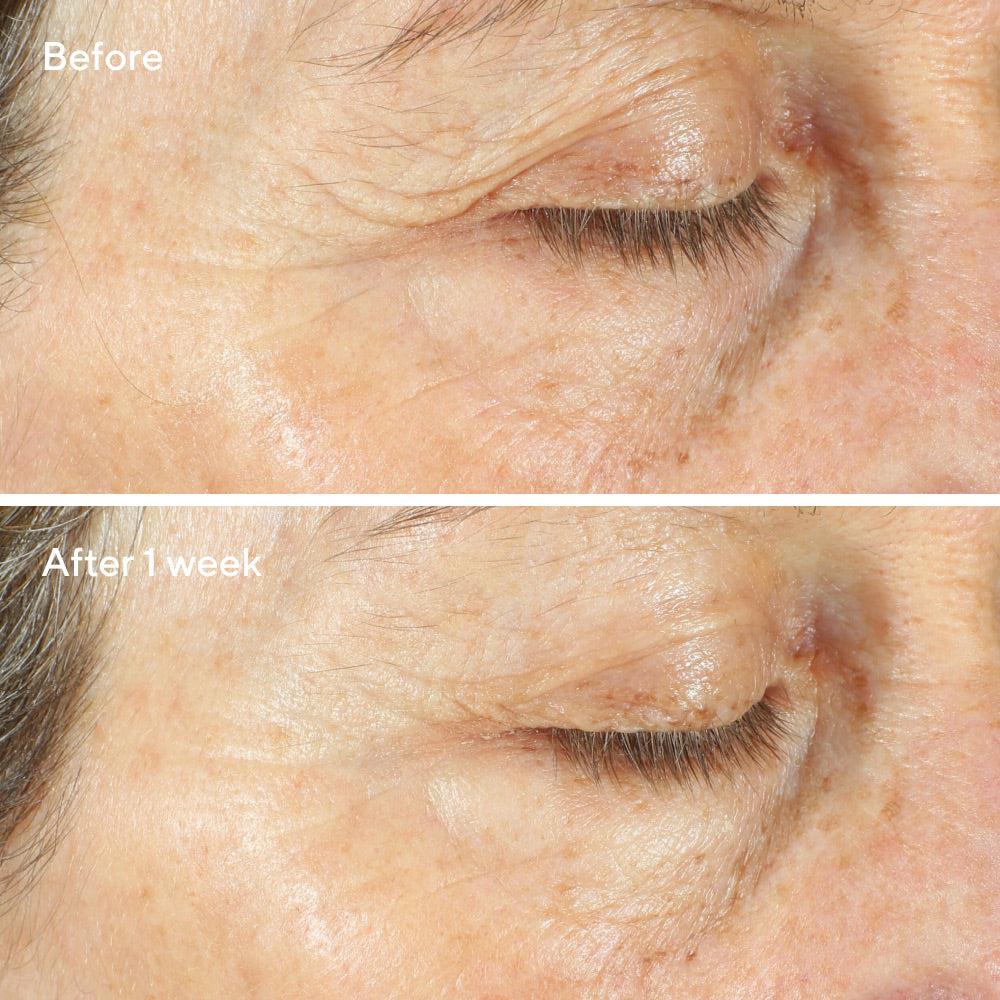 Murad Intense Recovery Cream 50ml