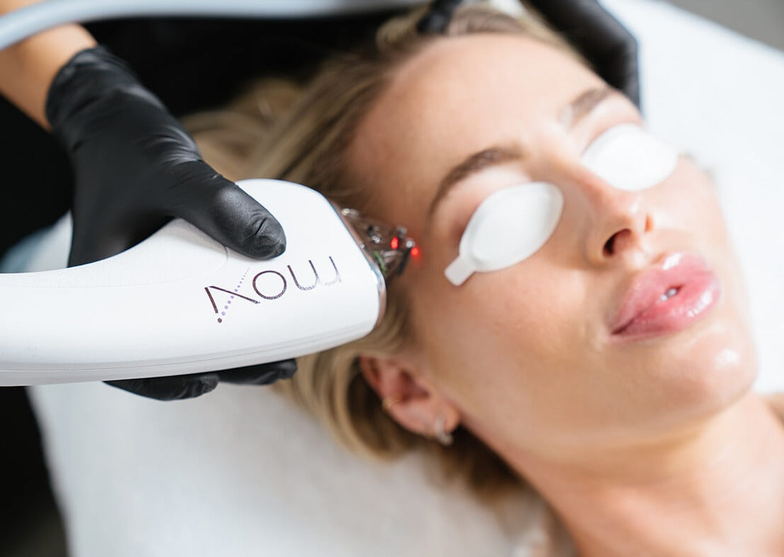 MOXI Laser Skin Rejuvenation course of 2 (save up to €801)