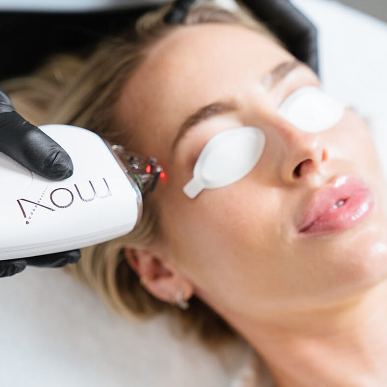 MOXI Laser Skin Rejuvenation course of 2 (save up to €801)