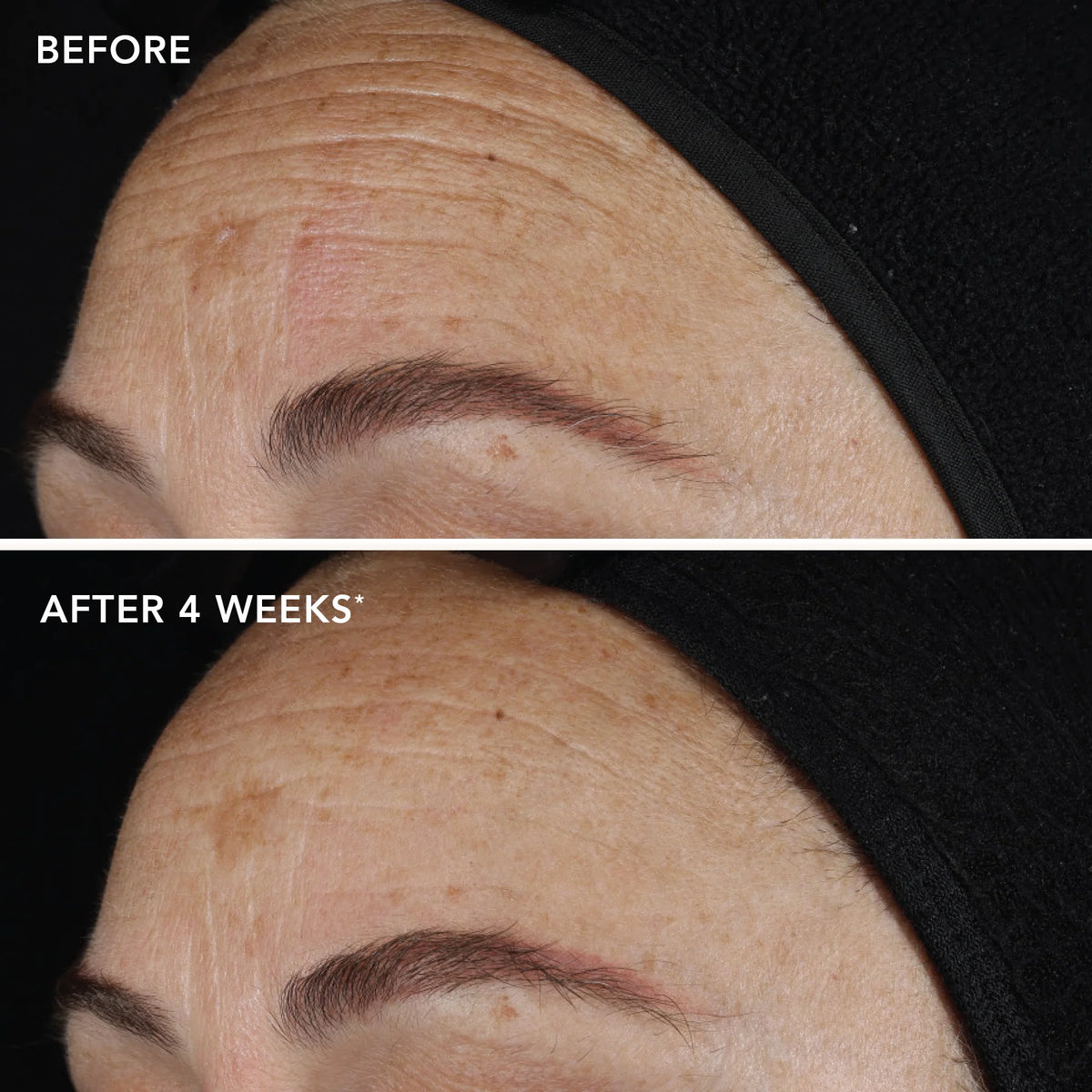 Image Skincare AGELESS+ Retinol Pure Liquid Retinol 0.1% 30ml