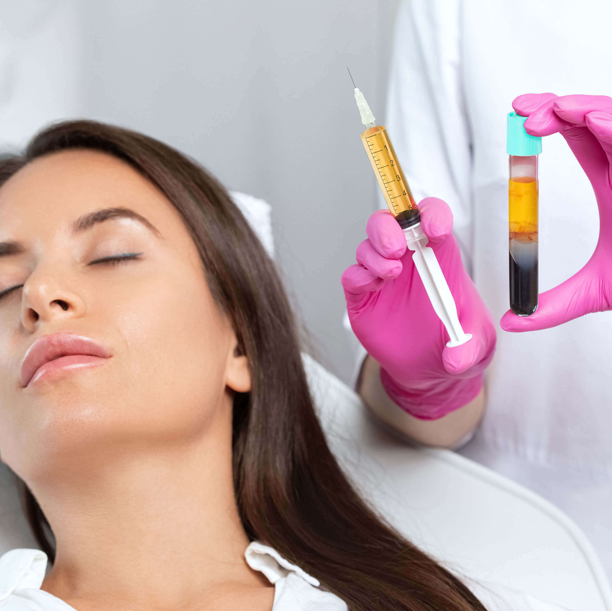 PRP with Exosomes for face or scalp course of 2 (save €451)