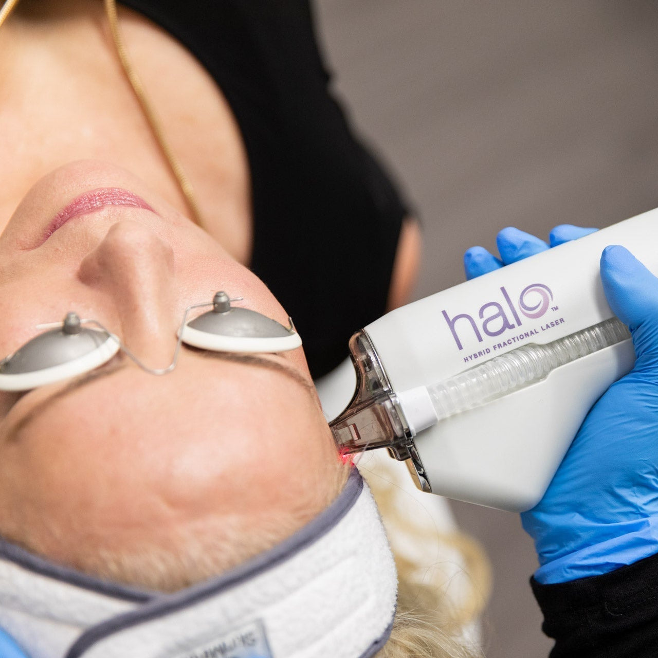 A person receiving a HALO Laser skin resurfacing treatment on their face.