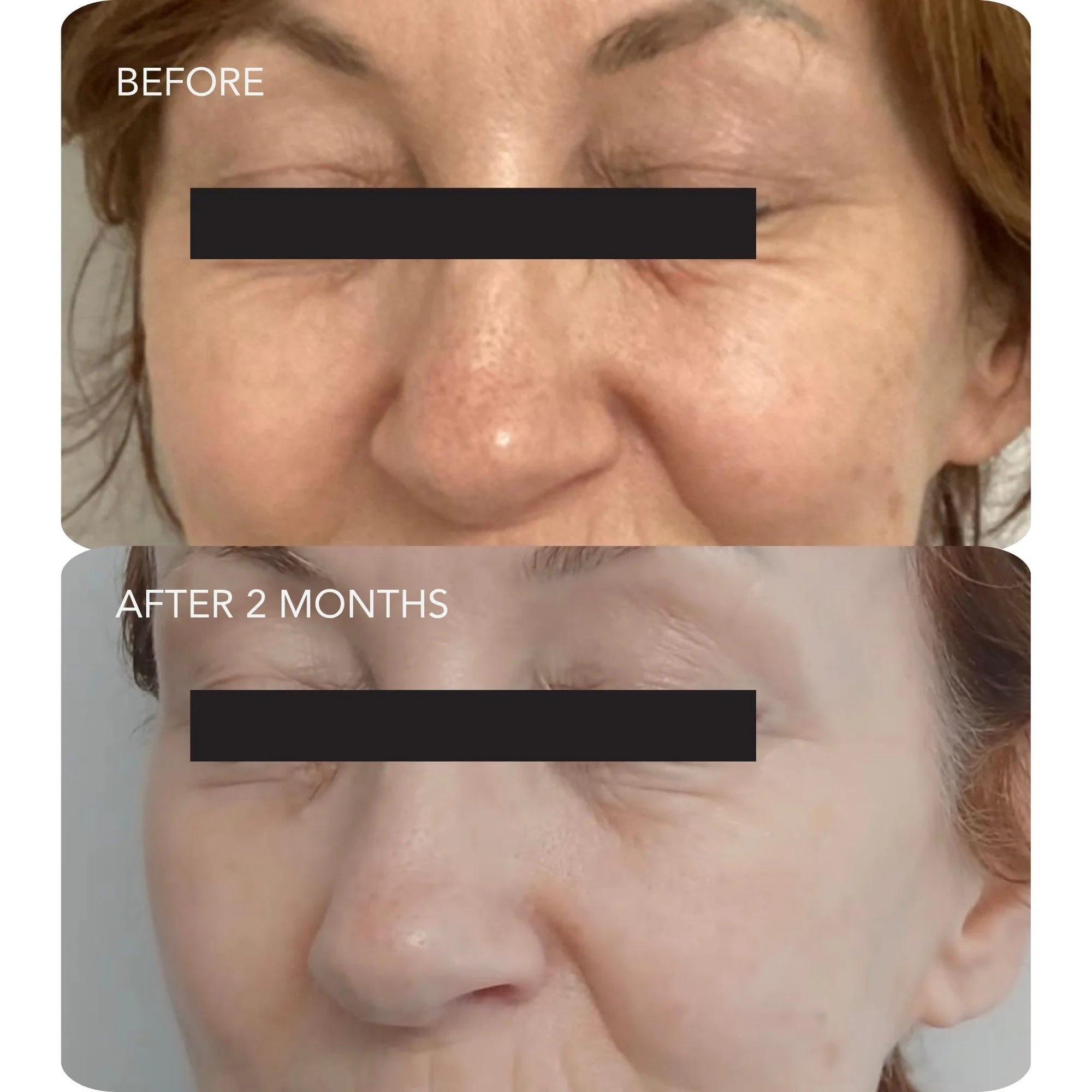 Image Skincare VOL.U.LIFT™ 4D Skin Rebound Complex