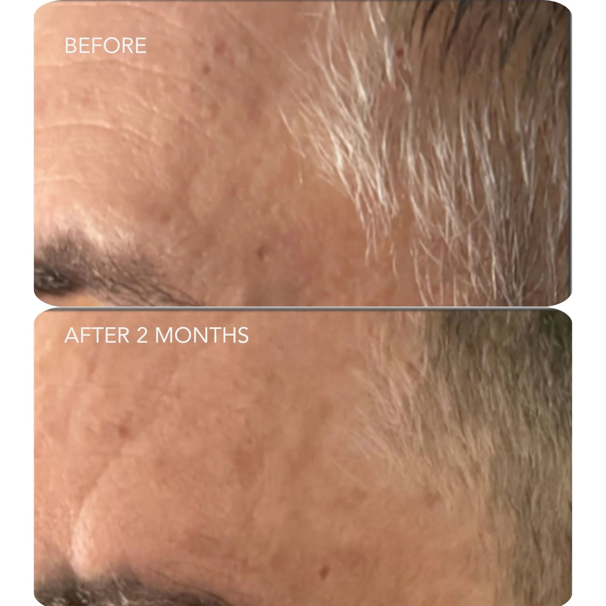 Image Skincare VOL.U.LIFT™ 4D Skin Rebound Complex