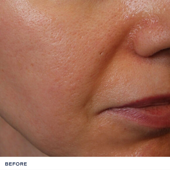 iS Clinical Daily Dynamic Hydrator