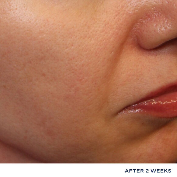 iS Clinical Daily Dynamic Hydrator