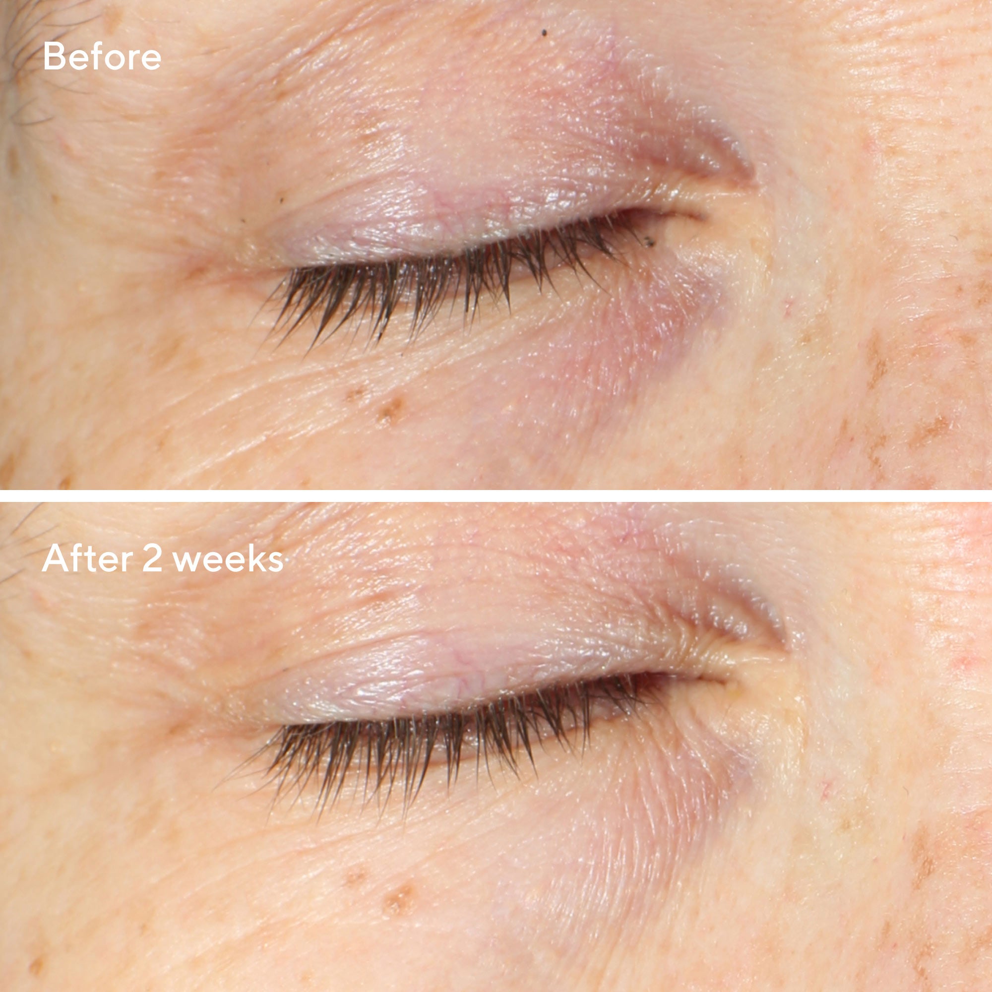 Murad Vita-C Eyes Dark Circle Corrector 15ml